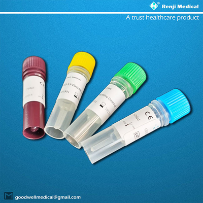 Resultados novos de Kit Complete do teste do antígeno de Coronavirus do CE 40-90 minutos