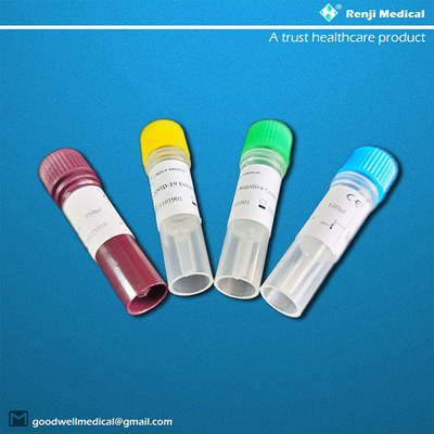 Aprovação do método ISO13485 do tempo real RT-PCR de Renji Nucleic Acid Testing Kit