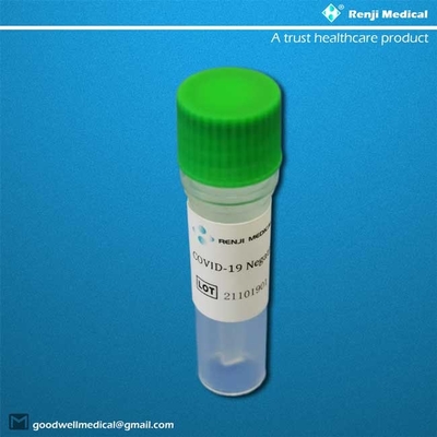 Teste Kit Oropharyngeal Nasopharyngeal da casa da sensibilidade Sars-Cov-2 de 95%